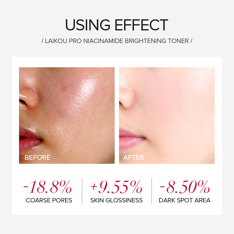LAIKOU PRO Niacinamide 4Pcs Br - Skincare Niacinamide recension och pris