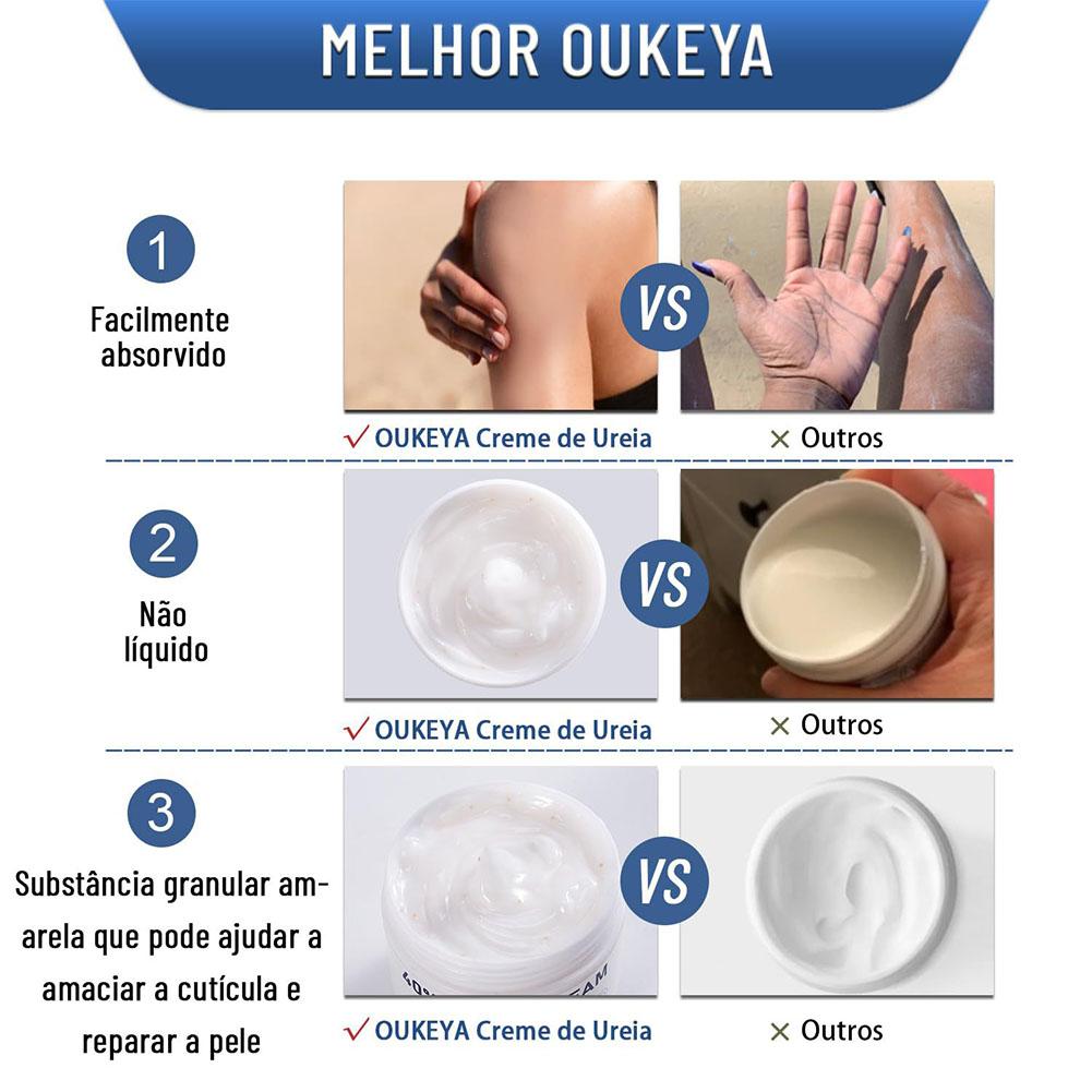 Urea Cream 40% Moisturizing An - Urea Foot Cream recension och pris
