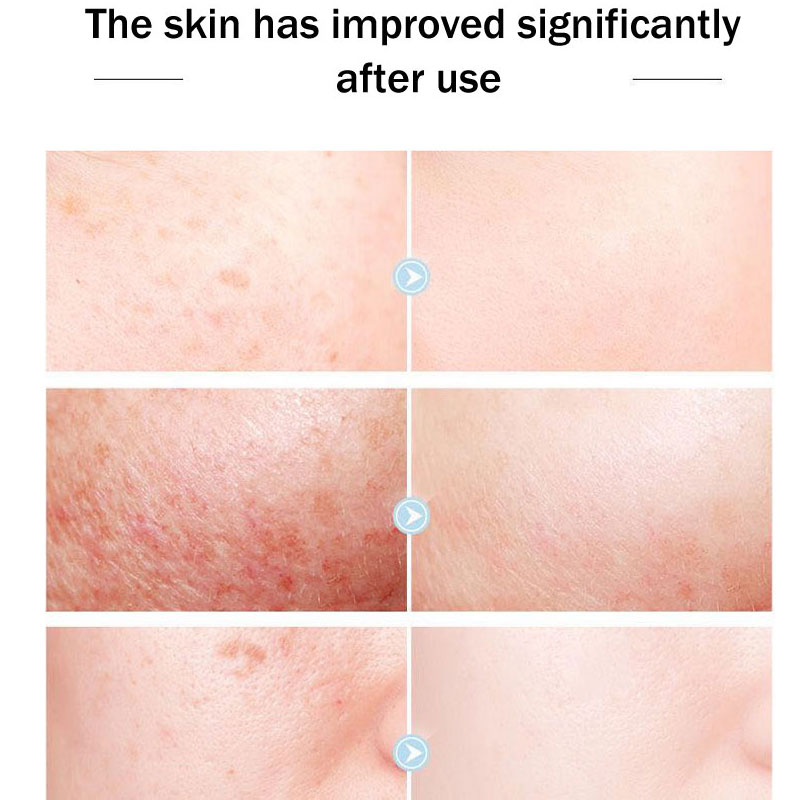 Original Queen Brand Face Crea - Skincare Queen recension och pris